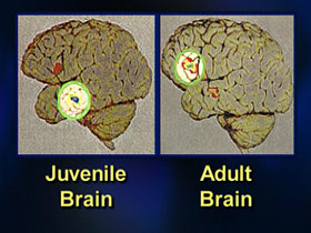 executingjuveniles-post06-braincompare