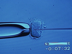 Embryo