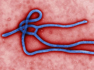 ebola_virus-NEWS-sm