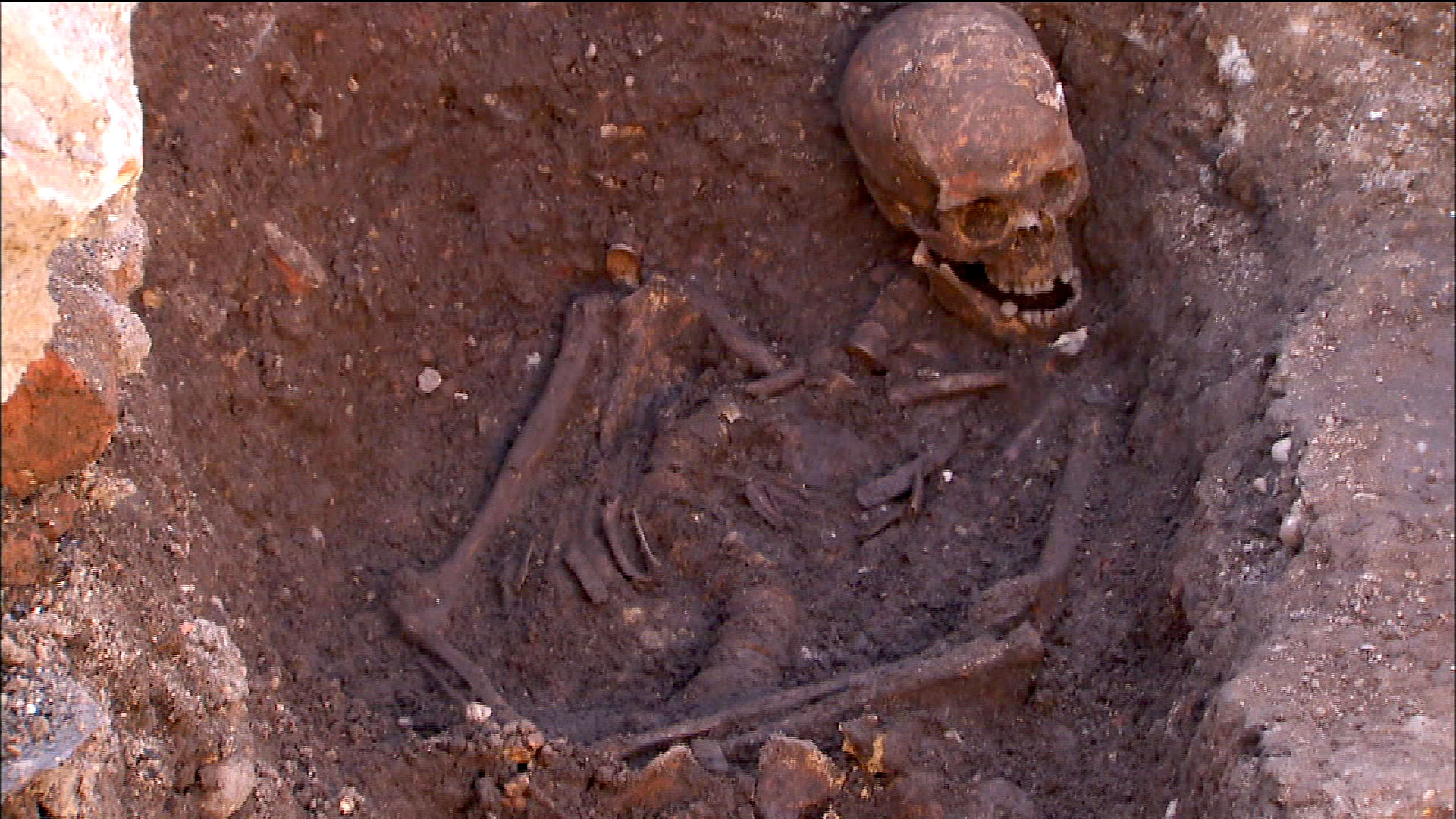 The Bones of Richard III