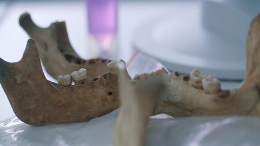 The End of the Romans -- Tooth Samples Reveal Scope of Justinianic Plague