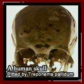 A human skull