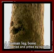 A human leg bone